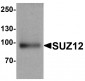 SUZ12 Antibody